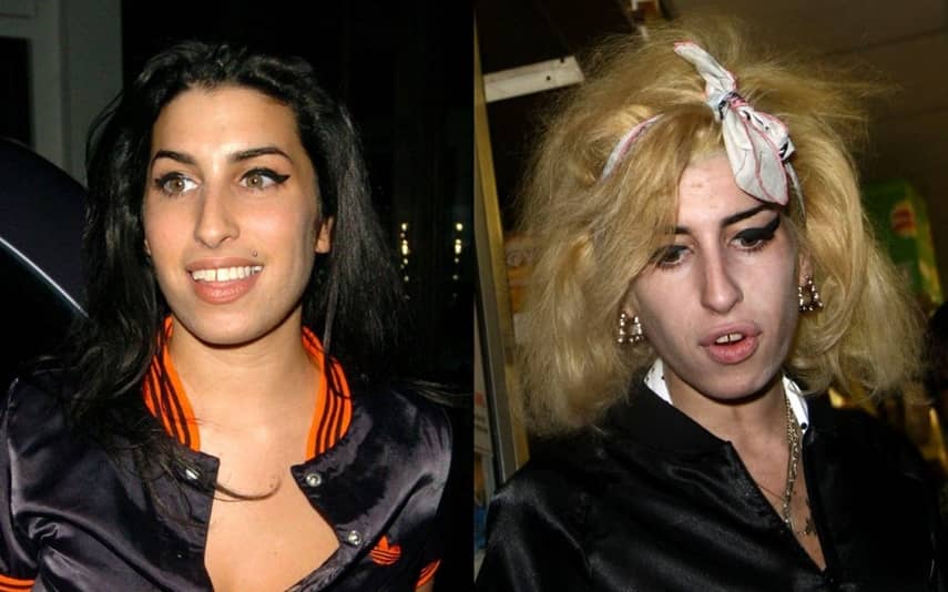 Amy Winehouse drogproblémák
